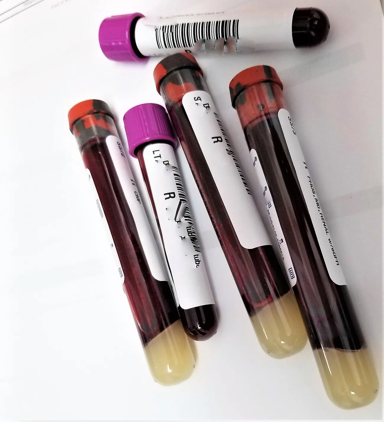 Labeled blood sample tubes resting on a lab requisition form