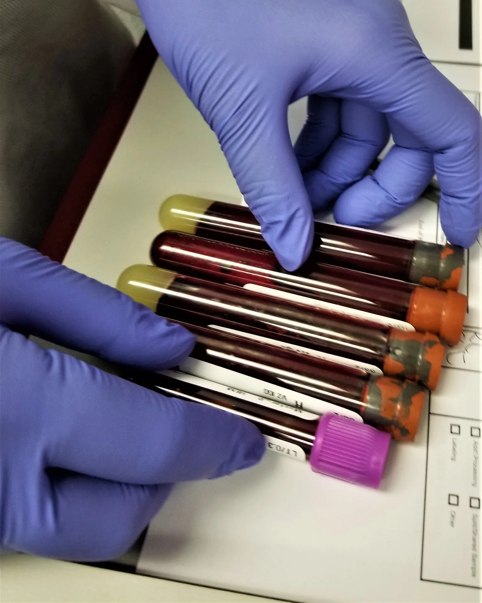 Advanced lab work and blood diagnostics