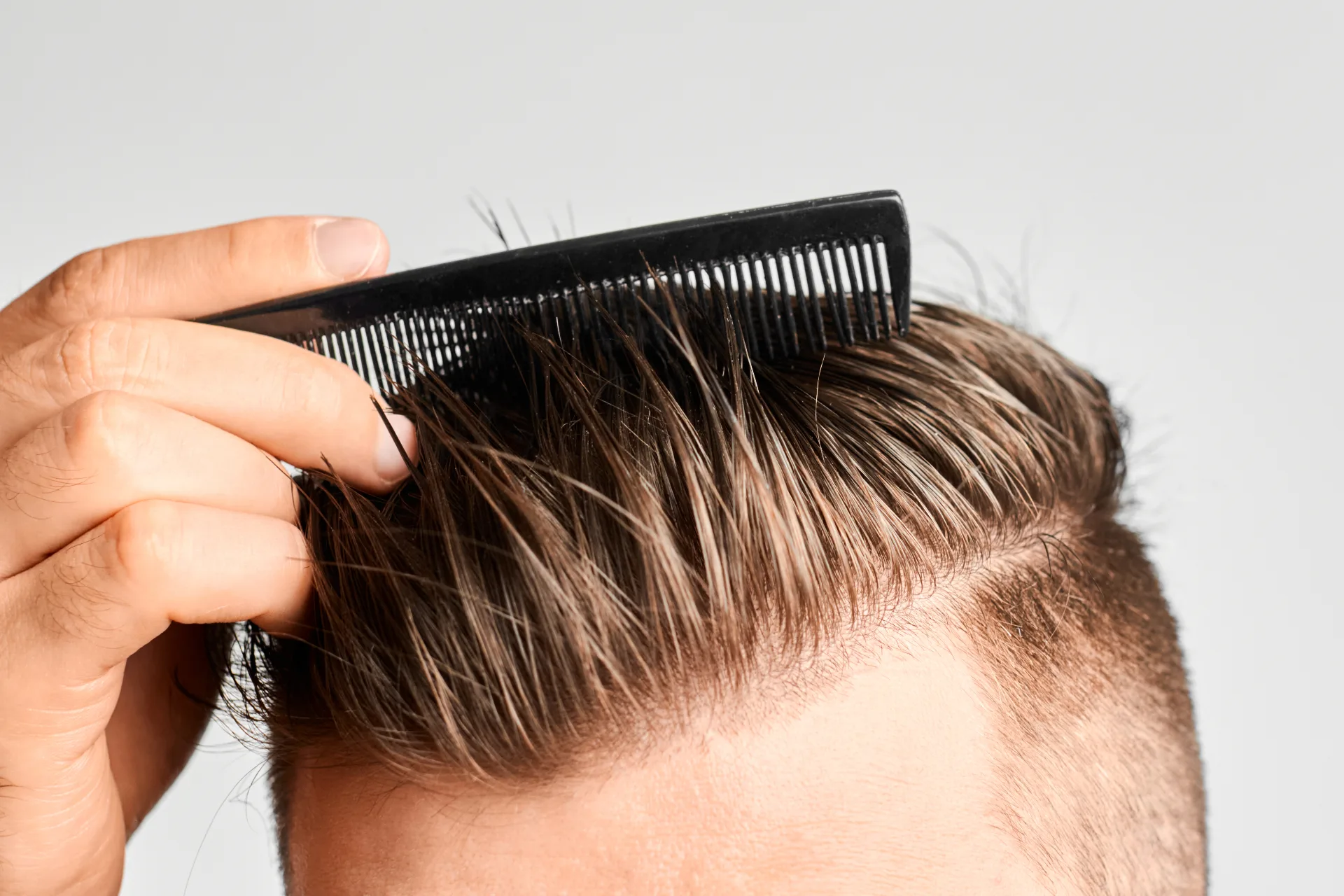 Hair Loss Treatment